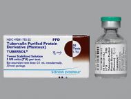 TUBERSOL 5TU 50TEST VIAL 5ML