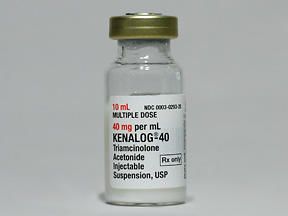 KENALOG 40 VL 40MG/ML 10ML